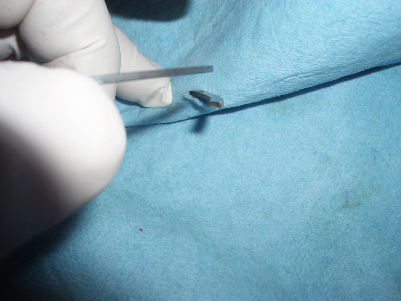 Taper (old ring will not reuse do not twist like this).jpg