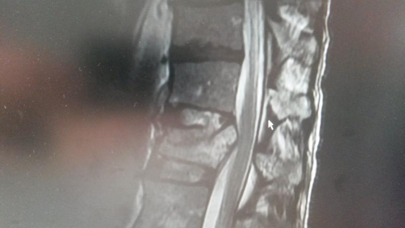 My back 20150909.jpg